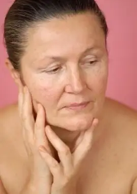 Pelle invecchiata con acne