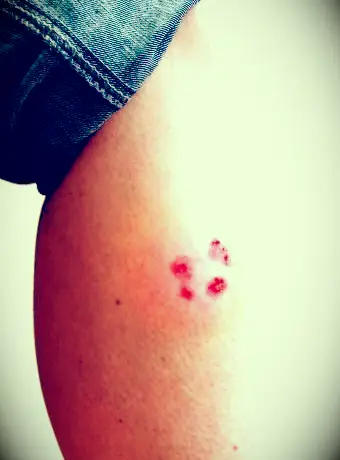 infizierte katze kratzen