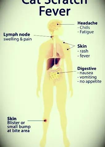 Symptome des Katzenkratzfiebers
