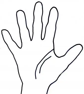 Doppia linea di vita