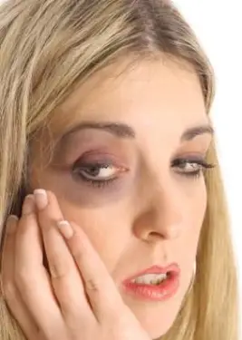 가정 폭력과 이혼 한 피해자의 권리