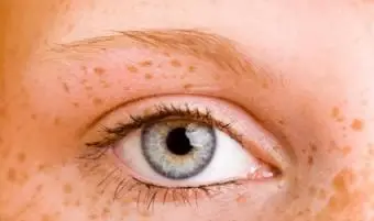 Vysvetlenie genetiky farieb očí