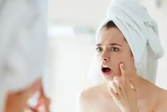 치약이 여드름을 제거합니까?