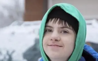 Zespół łagodnego Aspergera