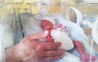 Čo môžete očakávať s dieťaťom narodeným v 24. týždni