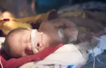 Frühgeborenes auf der neonatologischen Intensivstation schläft in seiner Isolette