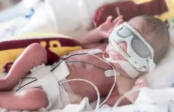 Was Sie von einem Baby erwarten können, das mit 32 Wochen geboren wurde Born