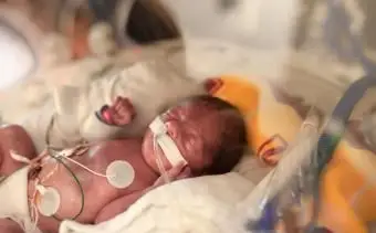 Cosa aspettarsi da un bambino nato a 29 settimane