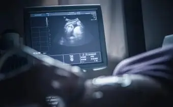 Femme enceinte ayant sonogramme