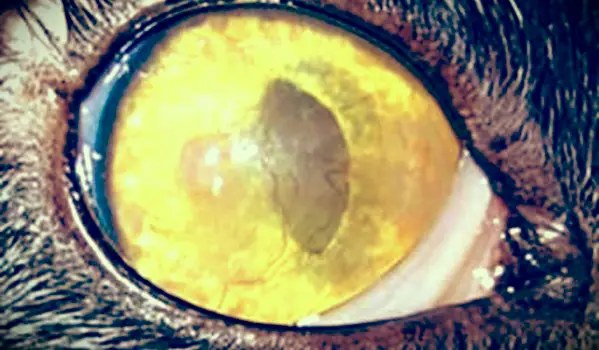 好酸球性角膜炎