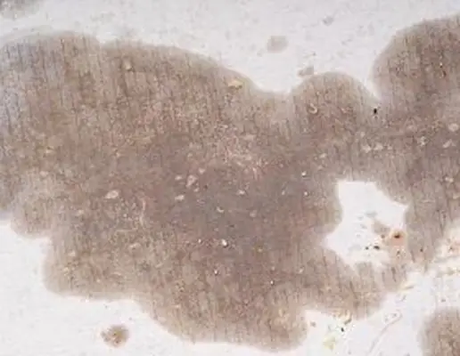 Odstránenie mastných škvŕn