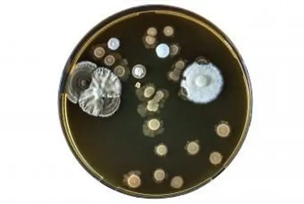 szalka Petriego z blastomyces dermatitidis