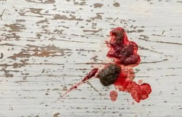 Hundekot durch Colitis