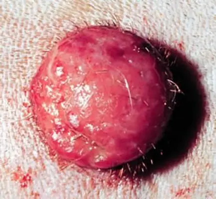 송곳니 피부 조직 구종