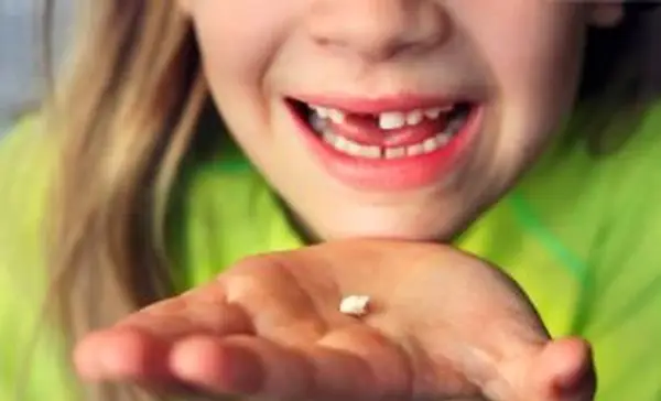 Niña, tenencia, diente de leche, ella, perdido