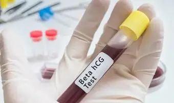 Prueba de embarazo con muestra de sangre