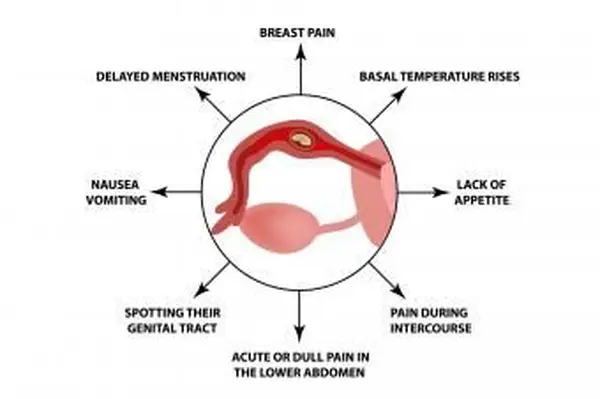 Príznaky mimomaternicového tehotenstva