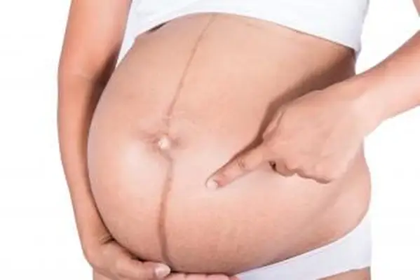 Linea Nigra on pregnant belly