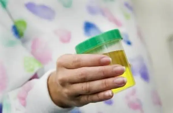 Urine jaune foncé pendant la grossesse