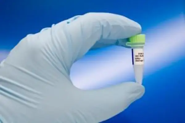 Pruebas de paternidad de ADN gratuitas y de bajo costo