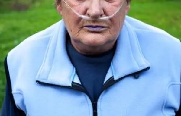 אדם עם שפתיים כחולות עקב COPD