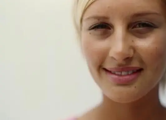 Significado das toupeiras no rosto