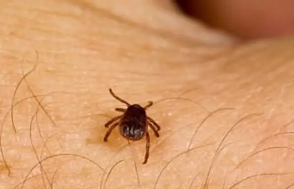 Erupção cutânea de picada de inseto