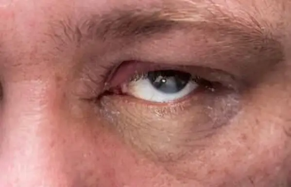 フェイシャルクレンジングフォーミュラリキッドニュートロジーナ