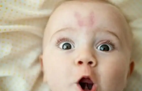 כתם לידה של כנפיים