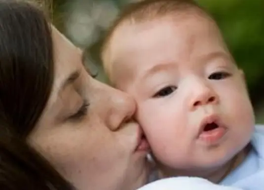 כתם לידה של אנג'ל נשיקה