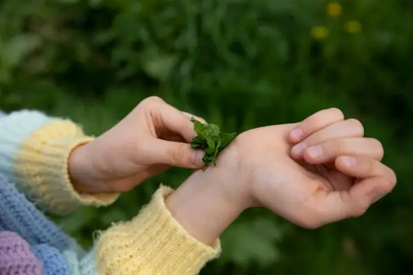 Rubbing dock leaf on to a nettle sting. Getty Images