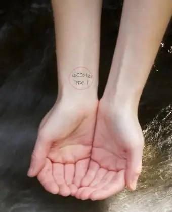 Tatuaggio di allerta medica per il diabete di tipo 1