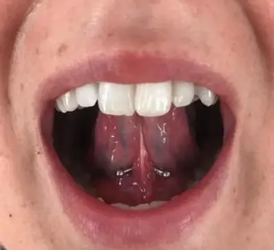 Ashley McElvy의 Frenulum 피어싱