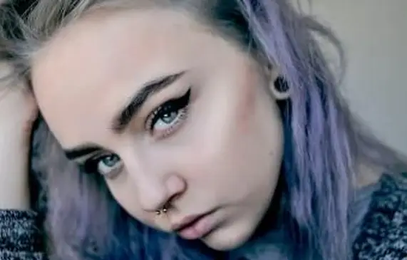 Nasenkeloid als Folge eines Piercings