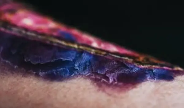 なぜ私のタトゥーは乳白色に見えるのですか？