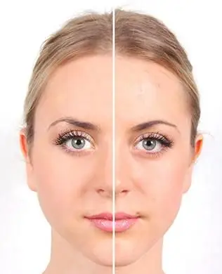 Las mejores bases para pieles propensas al acné